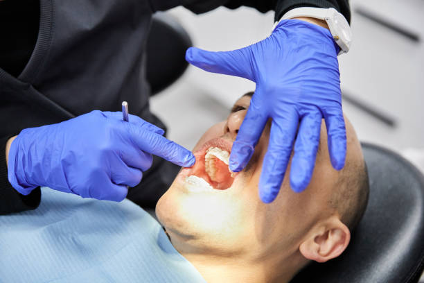 Best Emergency Root Canal Treatment in Erwin, NC